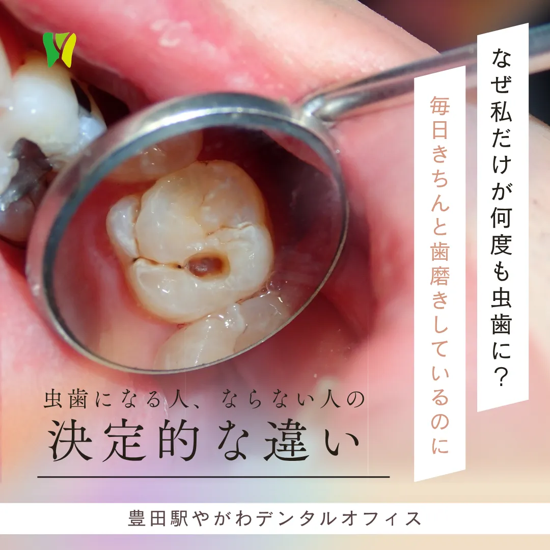 【20260612】毎日きちんと歯磨きしているのに虫歯になる人、ならない人の決定的な違い