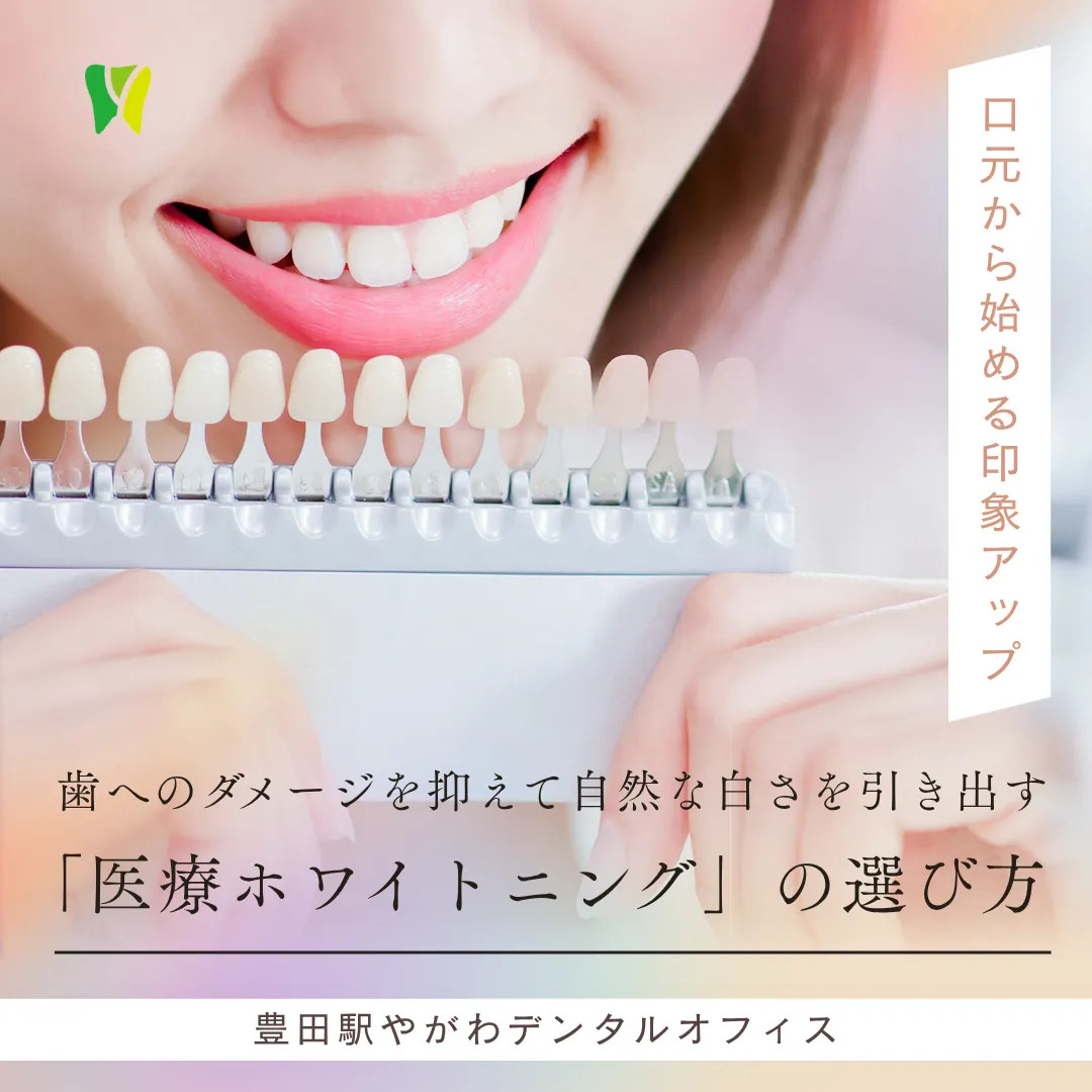 【20260918】口元から始める印象アップ。歯へのダメージを抑えて自然な白さを引き出す「医療ホワイトニング」の選び方