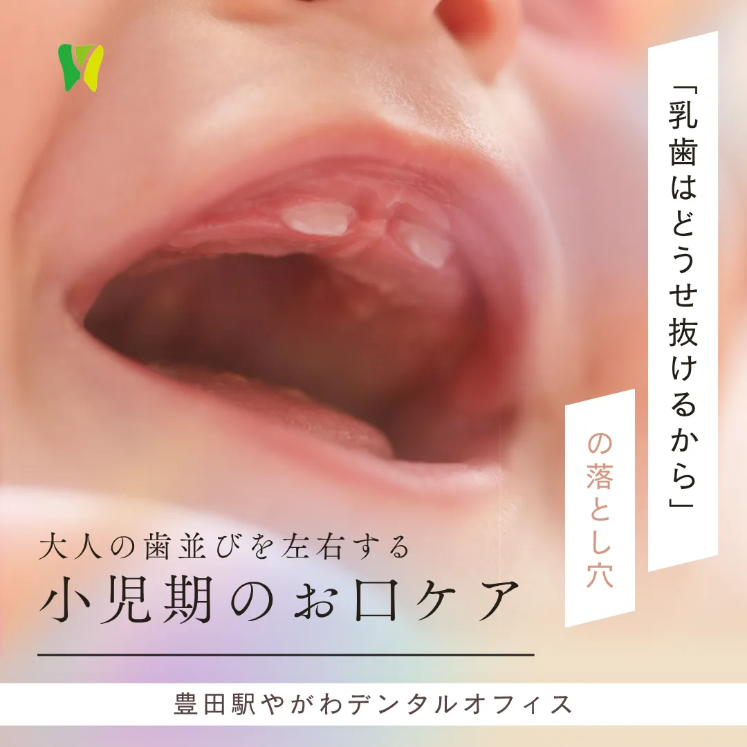 【20260710】「乳歯はどうせ抜けるから」の落とし穴。大人の歯並びを左右する小児期のお口ケア