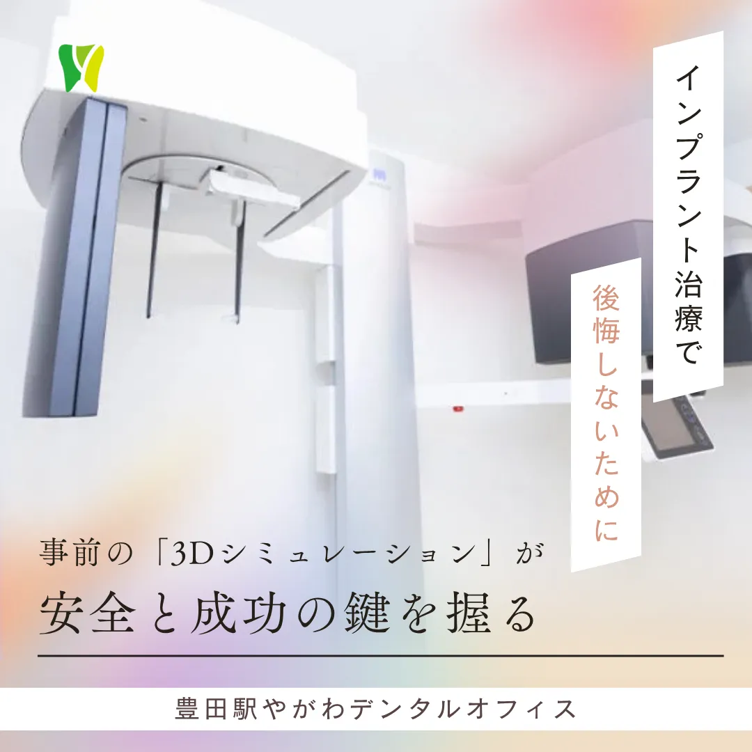 【20260904】インプラント治療で後悔しないために。事前の「3Dシミュレーション」が安全と成功の鍵を握る