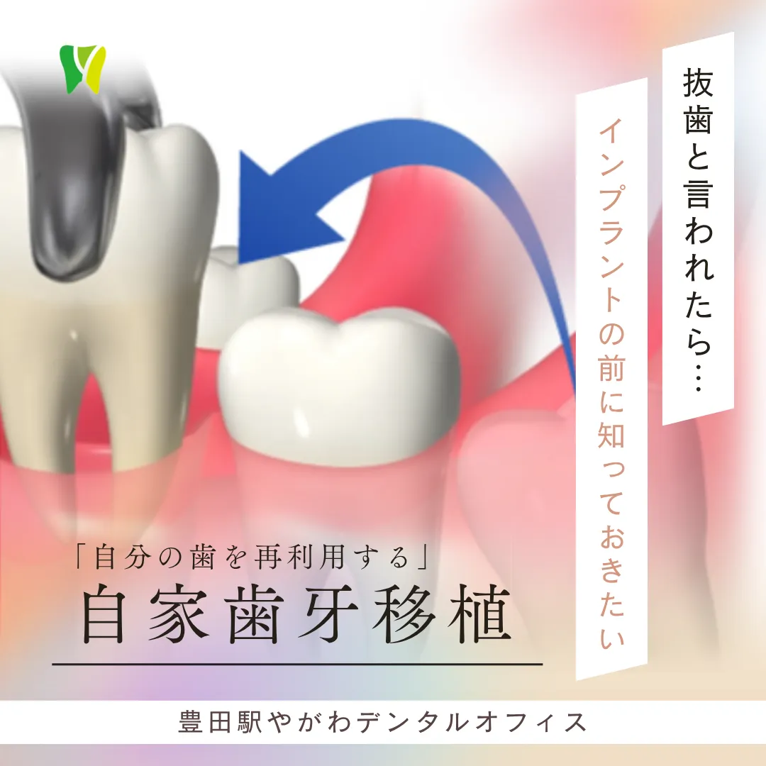 【20260529】抜歯と言われたら…インプラントの前に知っておきたい「自分の歯を再利用する」自家歯牙移植