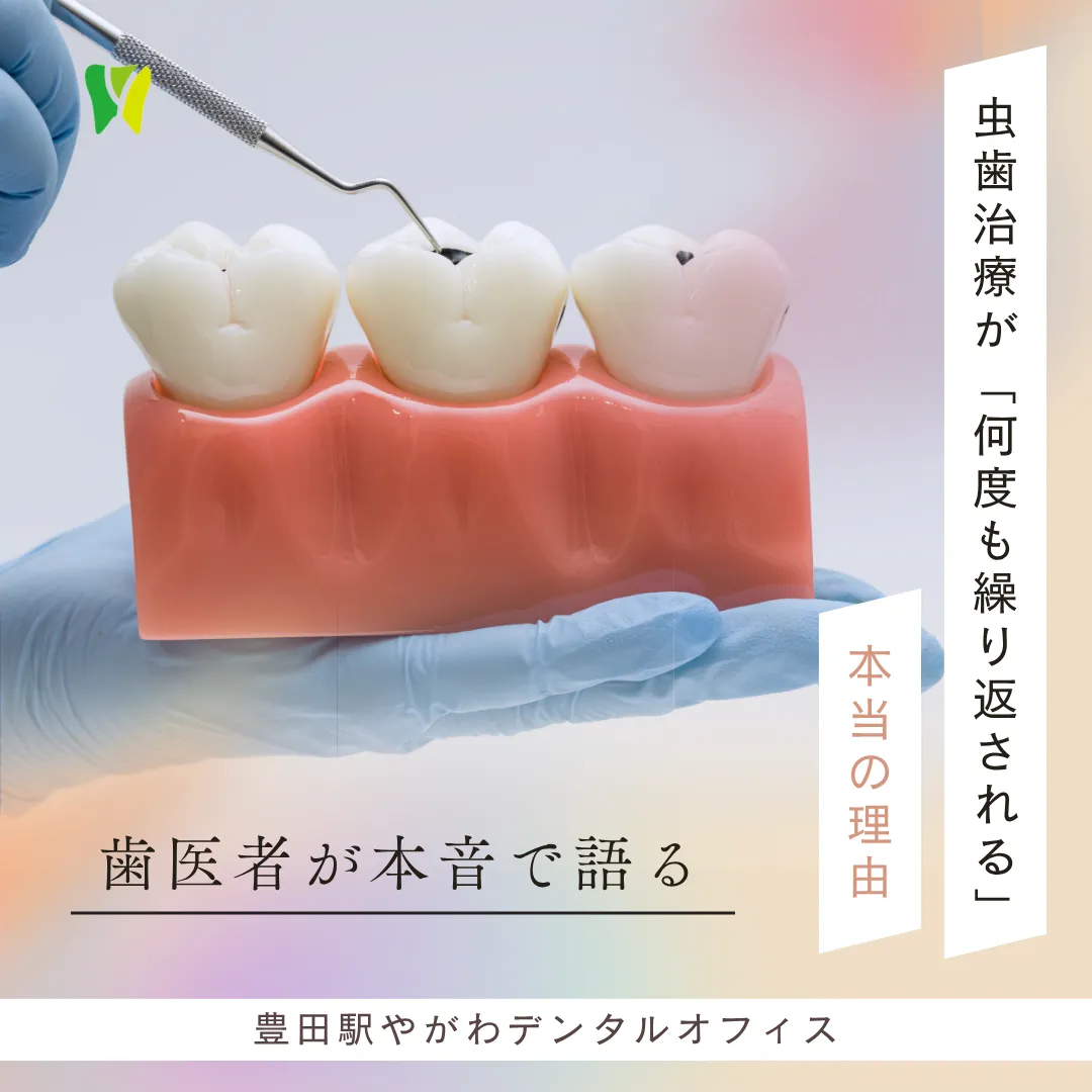 【20260403】歯医者が本音で語る、虫歯治療が「何度も繰り返される」本当の理由